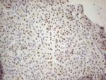 MALT1 Antibody in Immunohistochemistry (Paraffin) (IHC (P))