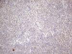 MALT1 Antibody in Immunohistochemistry (Paraffin) (IHC (P))