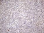 MALT1 Antibody in Immunohistochemistry (Paraffin) (IHC (P))