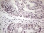 MALT1 Antibody in Immunohistochemistry (Paraffin) (IHC (P))