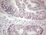 MALT1 Antibody in Immunohistochemistry (Paraffin) (IHC (P))