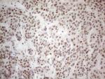 MALT1 Antibody in Immunohistochemistry (Paraffin) (IHC (P))