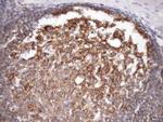 MALT1 Antibody in Immunohistochemistry (Paraffin) (IHC (P))