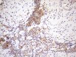 MALT1 Antibody in Immunohistochemistry (Paraffin) (IHC (P))