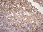 MALT1 Antibody in Immunohistochemistry (Paraffin) (IHC (P))