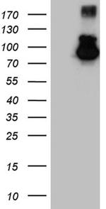 MALT1 Antibody in Western Blot (WB)