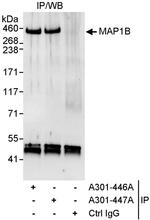 MAP1B Antibody in Immunoprecipitation (IP)