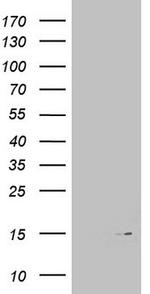 MAP1LC3A Antibody in Western Blot (WB)