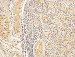 MAP1S Antibody in Immunohistochemistry (IHC)