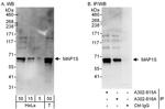 MAP1S Antibody in Western Blot (WB)