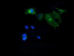 MAP2K1 Antibody in Immunocytochemistry (ICC/IF)