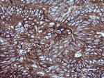 MAP2K1 Antibody in Immunohistochemistry (Paraffin) (IHC (P))