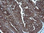 MAP2K1 Antibody in Immunohistochemistry (Paraffin) (IHC (P))