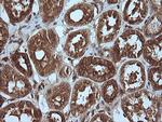 MAP2K1 Antibody in Immunohistochemistry (Paraffin) (IHC (P))