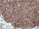 MAP2K1 Antibody in Immunohistochemistry (Paraffin) (IHC (P))