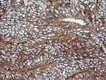 MAP2K1 Antibody in Immunohistochemistry (Paraffin) (IHC (P))