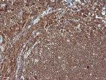 MAP2K1 Antibody in Immunohistochemistry (Paraffin) (IHC (P))