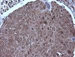 MAP2K1 Antibody in Immunohistochemistry (Paraffin) (IHC (P))