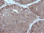 MAP2K1 Antibody in Immunohistochemistry (Paraffin) (IHC (P))