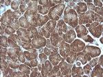 MAP2K1 Antibody in Immunohistochemistry (Paraffin) (IHC (P))