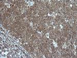 MAP2K1 Antibody in Immunohistochemistry (Paraffin) (IHC (P))