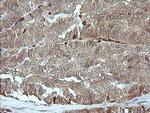 MAP2K1 Antibody in Immunohistochemistry (Paraffin) (IHC (P))