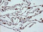 MAP2K1 Antibody in Immunohistochemistry (Paraffin) (IHC (P))