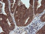 MAP2K1 Antibody in Immunohistochemistry (Paraffin) (IHC (P))