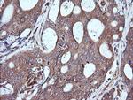 MAP2K1 Antibody in Immunohistochemistry (Paraffin) (IHC (P))