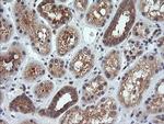 MAP2K1 Antibody in Immunohistochemistry (Paraffin) (IHC (P))