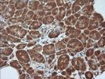 MAP2K1 Antibody in Immunohistochemistry (Paraffin) (IHC (P))