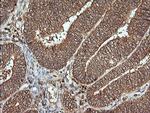 MAP2K1 Antibody in Immunohistochemistry (Paraffin) (IHC (P))