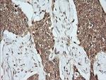 MAP2K1 Antibody in Immunohistochemistry (Paraffin) (IHC (P))