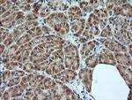 MAP2K1 Antibody in Immunohistochemistry (Paraffin) (IHC (P))