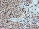 MAP2K1 Antibody in Immunohistochemistry (Paraffin) (IHC (P))