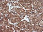 MAP2K1 Antibody in Immunohistochemistry (Paraffin) (IHC (P))