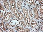 MAP2K1 Antibody in Immunohistochemistry (Paraffin) (IHC (P))