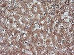 MAP2K1 Antibody in Immunohistochemistry (Paraffin) (IHC (P))