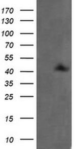 MAP2K1 Antibody in Western Blot (WB)