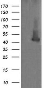 MAP2K1 Antibody in Western Blot (WB)