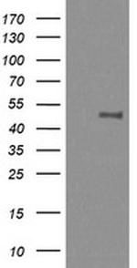 MAP2K1 Antibody in Western Blot (WB)