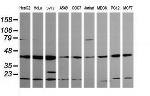 MAP2K1 Antibody in Western Blot (WB)