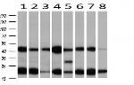 MAP2K1 Antibody in Western Blot (WB)