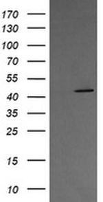 MAP2K1 Antibody in Western Blot (WB)