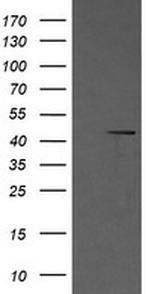 MAP2K1 Antibody in Western Blot (WB)