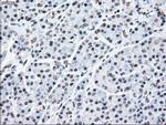 MAP2K2 Antibody in Immunohistochemistry (Paraffin) (IHC (P))