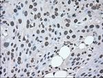 MAP2K2 Antibody in Immunohistochemistry (Paraffin) (IHC (P))