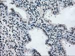 MAP2K2 Antibody in Immunohistochemistry (Paraffin) (IHC (P))