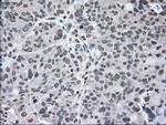 MAP2K2 Antibody in Immunohistochemistry (Paraffin) (IHC (P))