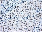 MAP2K2 Antibody in Immunohistochemistry (Paraffin) (IHC (P))